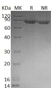 Human CDH11/hCG_26636 (His tag) recombinant protein