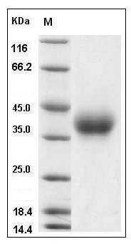 Mouse CD84 Protein (His Tag) SDS-PAGE