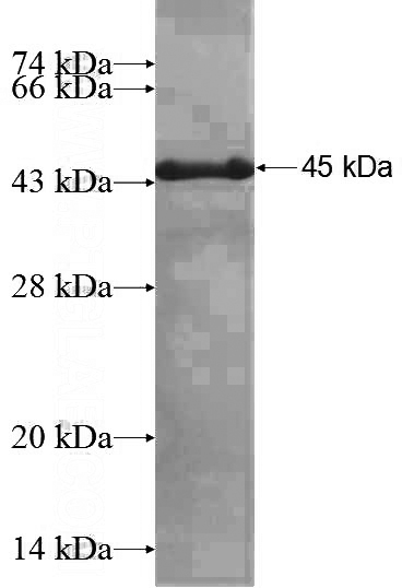 Recombinant Human CGGBP1 SDS-PAGE