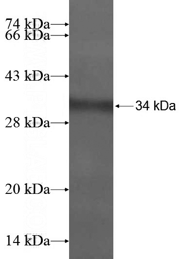 Recombinant Human SCGB2A2 SDS-PAGE