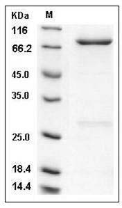 Human PDE9A Protein (His & GST Tag) SDS-PAGE
