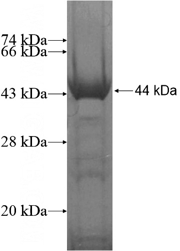 Recombinant Human C11orf2,ANG2 SDS-PAGE