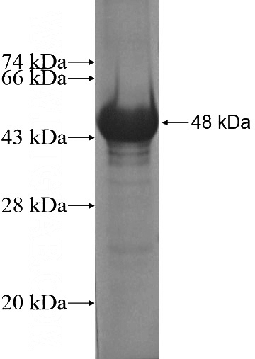 Recombinant Human ZNF205 SDS-PAGE