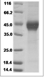 Mouse DKK1/Dkk-1 Protein 15527