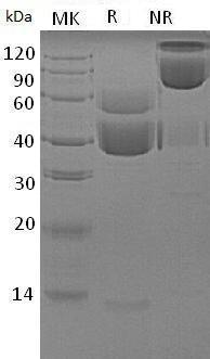 Human TGFB1/TGFB (His tag) recombinant protein