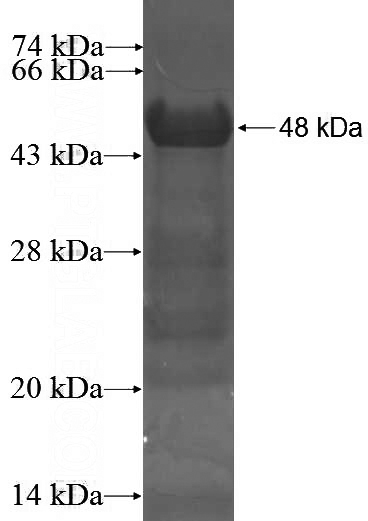 Recombinant Human C1orf149 SDS-PAGE