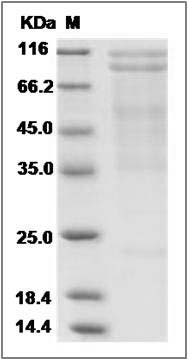 Mouse N-Cadherin / CD325 / CDH2 Protein SDS-PAGE