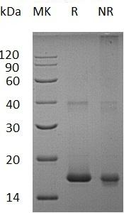 Human IL1F10/FIL1T/IL1HY2/IL38 recombinant protein