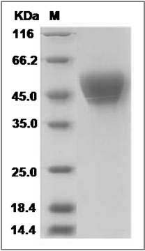 Mouse AMICA1 / JAML Protein (His Tag) SDS-PAGE