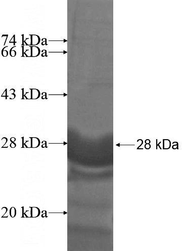 Recombinant Human LYSMD2 SDS-PAGE