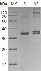 Human CDK2/CDKN2 (His tag) recombinant protein
