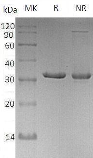 Human CLIC5 (His tag) recombinant protein