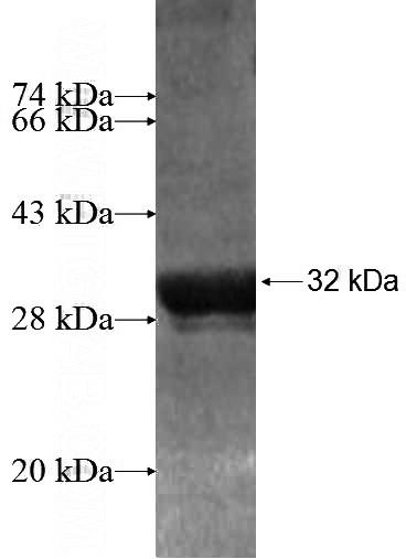 Recombinant Human PCDHA6 SDS-PAGE