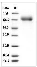 Influenza A H1N1 (A/New Caledonia/20/1999) Hemagglutinin / HA Protein (His Tag) SDS-PAGE