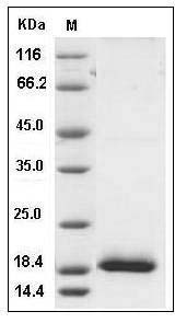 Human CCL24 / Eotaxin-2 / MPIF-2 Protein (His Tag) SDS-PAGE