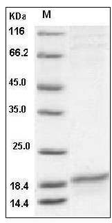 Human SLPI Protein (His Tag) SDS-PAGE