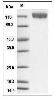 Human VEGFR2 / Flk-1 / CD309 / KDR Protein (His Tag) SDS-PAGE