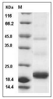Human PDGF-C / SCDGF Protein (His Tag) SDS-PAGE