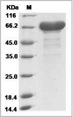 Ebola virus EBOV (subtype Zaire, strain strain H.sapiens-wt/GIN/2014/Kissidougou-C15) VP40 / Matrix protein VP40 Protein (His & MBP Tag)