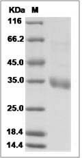 MERS-CoV (HCoV-EMC/2012) Spike Protein fragment (RBD, aa 367-606, His Tag) SDS-PAGE