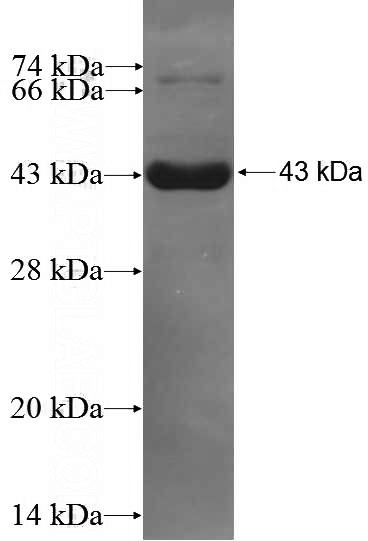 Human TMED10 Recombinant protein (GST tag)