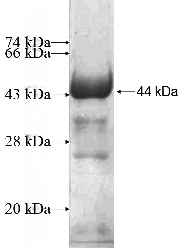 Recombinant Human CNOT10 SDS-PAGE