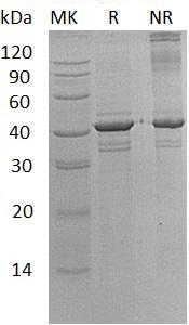 Human CALR3/CRT2 recombinant protein