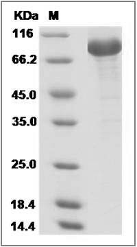Human SARS Coronavirus Spike S1 Subunit Protein (His Tag) SDS-PAGE