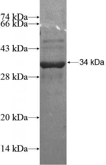 Recombinant Human ZNRF4 SDS-PAGE