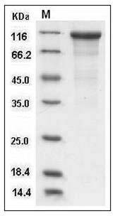 Human Cadherin-17 / LI-cadherin / CDH17 Protein (His Tag) SDS-PAGE