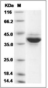 Human Jumping Translocation Breakpoint / JTB Protein (Fc Tag) SDS-PAGE
