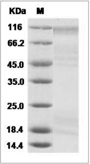Ebola virus EBOV (Subtype Sudan, strain Gulu) Glyprotein / GP Protein (aa: Met1-Asn637, His Tag)\n