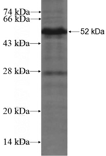 Recombinant Human EHMT2 SDS-PAGE