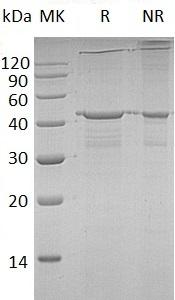 Human IGF2BP2/IMP2/VICKZ2 (His tag) recombinant protein
