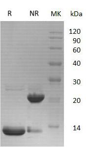 Human S100A6/CACY (His tag) recombinant protein
