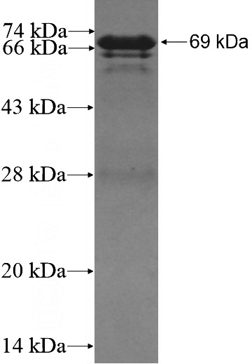 Recombinant Human ZNF18 SDS-PAGE