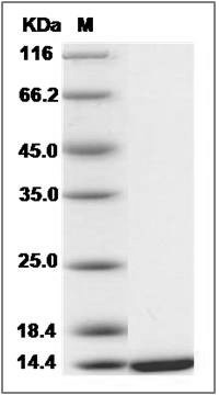 Human CRABP1 / RBP5 Protein SDS-PAGE