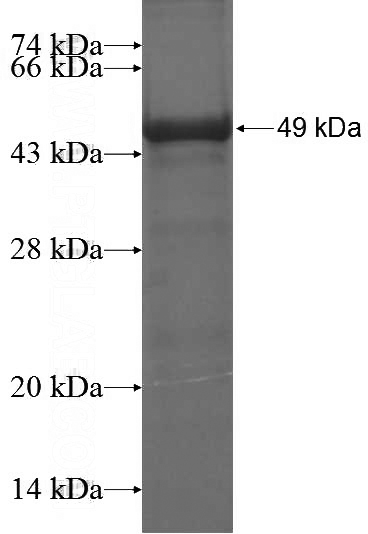 Recombinant Human C17orf75 SDS-PAGE