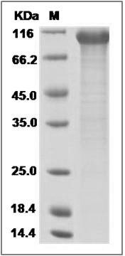 Cynomolgus FGFR3 Protein (Fc Tag) SDS-PAGE
