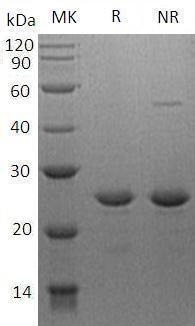 Human HSF2/HSTF2 (His tag) recombinant protein