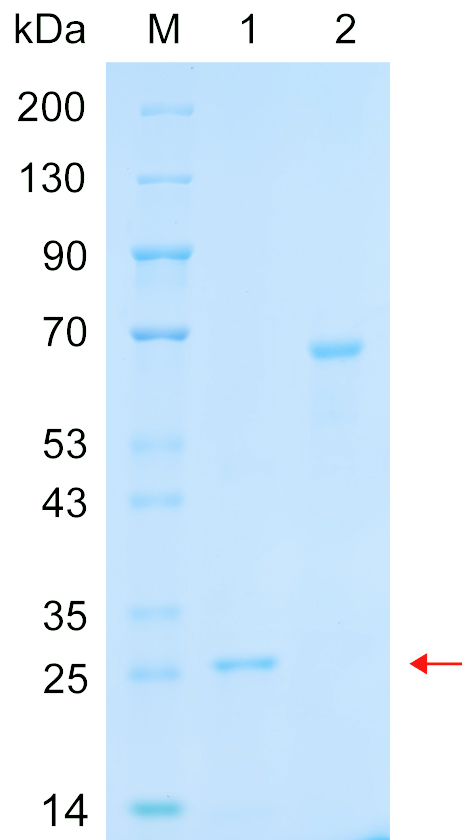 Recombinant TBXT protein (His tag) SDS-PAGE