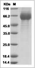 Influenza A H3N2 (A/Texas/50/2012) Hemagglutinin Protein (HA1 Subunit) (His Tag)