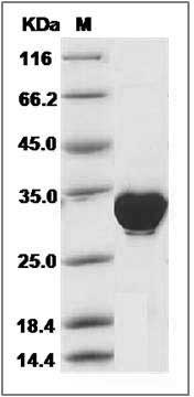 Human PLS3 / Plastin 3 Protein (His Tag) SDS-PAGE
