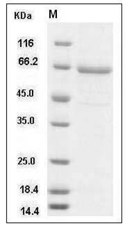 Human TLR2 / CD282 Protein (aa 1-587, His Tag) SDS-PAGE