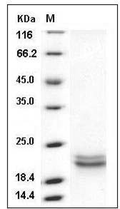 Human SCF / C-kit ligand Protein (aa 1-189, His Tag) SDS-PAGE