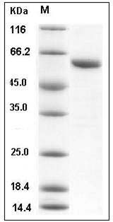 Human TXNRD1 / TRXR1 Protein (aa 161-647, His Tag) SDS-PAGE