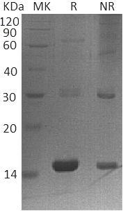 Human PLA2G16/HRASLS3/HREV107 (His tag) recombinant protein