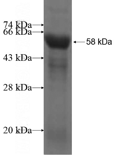 Recombinant Human NF45 SDS-PAGE