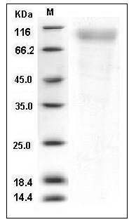 Human CD180 / RP105 / LY64 Protein (His Tag) SDS-PAGE
