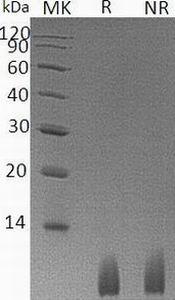 Human UBB (GST & His tag) recombinant protein